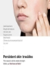 سرم صورت Niacinamide کره ای Galactomy Niacin Essence، درمان کننده پوست کدر، رنگ پوست ناهموار برای زنان و مردان، Essential Skincare Starter Korean Skin Care 1.69 Fl. اوز (50 میلی لیتر)