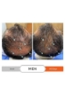 شامپو Revita برای موهای نازک کننده با شامپو حجم دهنده و ضخیم کننده برای مردان و زنان شامپو برای حمایت از رشد مو تقویت کننده موی تقویت کننده بدون سولفات DT Blocker (205 میلی لیتر)