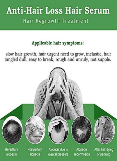سرم رشد مو، درمان ریزش و نازک شدن مو، متوقف کننده ریزش مو، نازک شدن، طاس شدن، ترمیم فولیکول های مو، تقویت موهای ضخیم تر، قوی تر و رشد موهای جدید