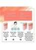 ابزار آرایشی میکرونیدلینگ Derma Roller با 540 سوزن برای ریزش موی پوست آکنه با کیف ذخیره سازی رایگان (رزگلد 1.00 میلی متر)