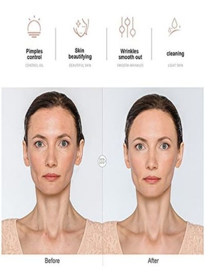 دستگاه نور درمانی گرز صورت فرکانس بالا نئون برای سفت کردن پوست/فولیکول مو/دستگاه زیبایی صورت