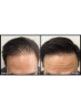 روغن کانتاریدین برای مو | کنترل ریزش مو | کاهش شوره سر | روغن رشد مو|ساخت هند (200 میلی لیتر) |روغن/سرم رشد مو چند منظوره برای درمان کامل مو با آرگان برینگراج