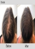 پودر پرکننده روز مو - پوشش ریشه برای موهای نازک - موهای ضخیم تر و پرتر (بلوند)