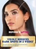بسته ضد لک و لک صورت NIVEA: سرم روزانه Clear Up Face 50ml + LUMINOUS 630 EVEN GLOW Face Cream Night Repair 50ml + هدیه: کیف طلایی ممتاز برای زنان