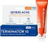 تصویر  کرم درمان آکنه AcneFree Terminator 10 Acne Spot Treatment with Benzoyl Peroxide 10% Maximum Strength Acne Cream Treatment, 1 Ounce - Pack Of 1