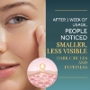 Matykos-Forehead-Under-Wrinkle-Patches